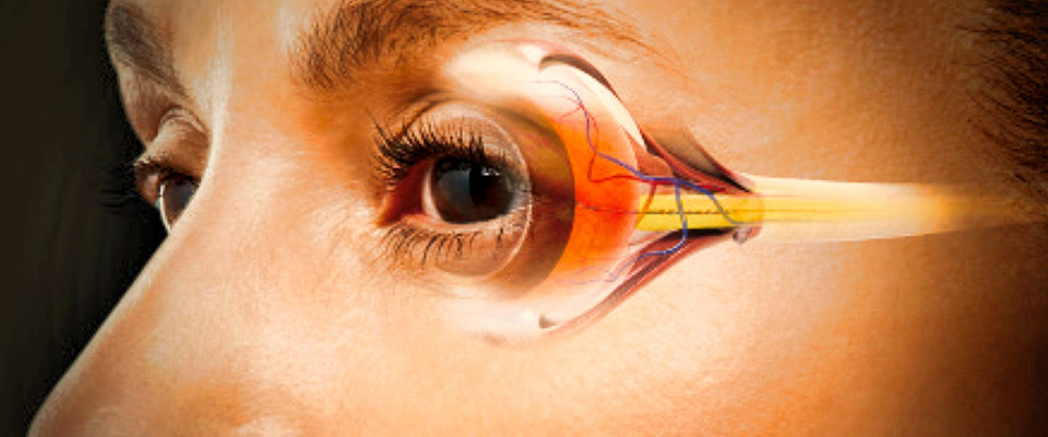 18 марта – Семинар «Профилактика глаукомы. Взаимодействие с пациентом»