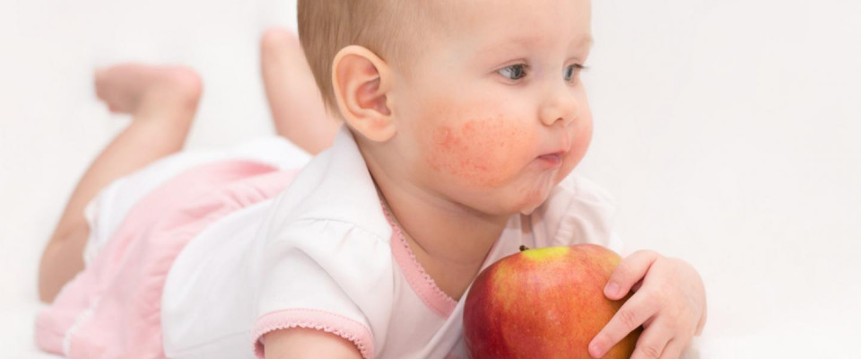 17 декабря – Семинар «Как уберечь ребенка от аллергии: миф и реальность»