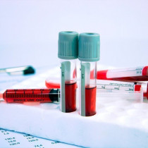 4 АВГУСТА – Онлайн – мастер-класс «Изменения в общем анализе крови при бактериальных и вирусных инфекциях. Сложности диф. диагностики клеток крови при микроскопии»