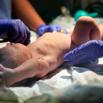 12 ноября – Семинар «Родовые травмы новорожденных»